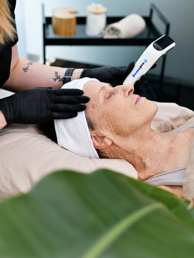 ☀️ Voiko Dermapen 4 -mikroneulaushoidon tehdä myös kesällä?Kyllä voi! 💛 Dermapen 4 -hoito ei ole este kesäiholle, kunhan hoidonjälkeisestä ihonhoidosta huolehditaan oikein.Kesällä mikroneulauksen jälkeen on erityisen tärkeää:
✔️ Käyttää päivittäin SPF 50 -aurinkosuojaa
✔️ Huolehtia ihon riittävästä kosteutuksesta
✔️ Välttää voimakasta auringonottoa ensimmäisten päivien aikana
✔️ Suojata iho tarvittaessa hatulla tai muulla fyysisellä suojalla
✔️ Noudattaa hoitajan antamia jälkihoito-ohjeitaMikroneulaus voi auttaa ylläpitämään ihon hehkua, tasoittamaan ihon rakennetta ja tukemaan ihon uusiutumista myös kesäkaudella. ✨Poikkeuksena ovat henkilöt, joilla on voimakas taipumus hyperpigmentaatioon (ihon tummumiseen). Tällöin hoidon ajankohta arvioidaan aina yksilöllisesti, ja joskus hoito kannattaa siirtää vähäisemmän UV-säteilyn aikaan.Mietitkö, sopiiko Dermapen 4 juuri sinulle? Ota yhteyttä, niin arvioidaan tilanteesi yhdessä. 💫#dermapen4 #mikroneulaus #ihonhoito #kesäiho #hehkuvaiho